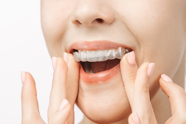 What Are ClearCorrect Braces?