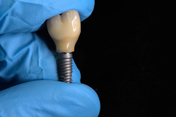 How Does A Dental Implant Compare To Other Tooth Replacement Options?