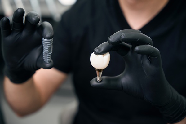 Dental Implant Restorations For Worn Or Loose Teeth: Treatment Pathways
