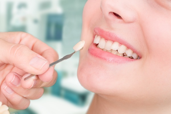 Dental Veneers To Fix A Gap Between Teeth