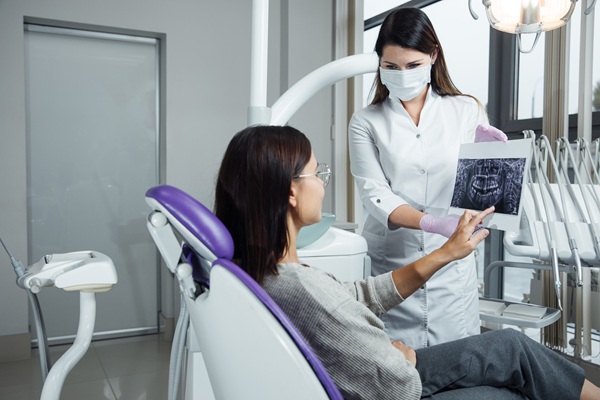 An Overview Of The Full Mouth Reconstruction Treatment Process