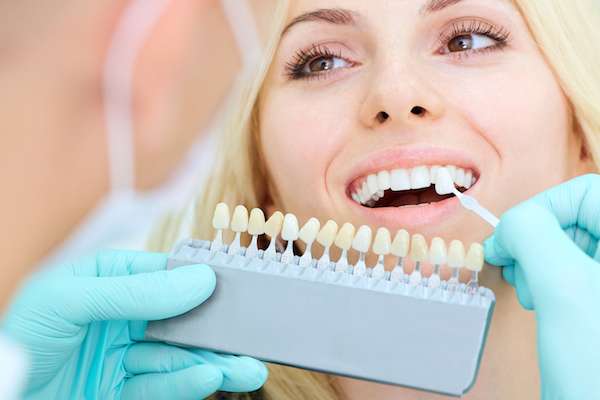 How a Cosmetic Dentist Places Dental Veneers from GDC Smiles in Gainesville, GA