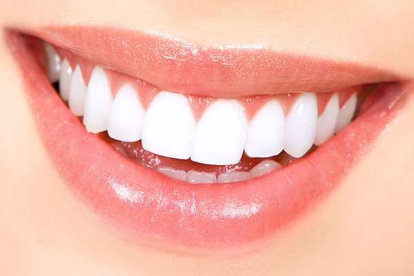 How Long Does Teeth Whitening Take from GDC Smiles in Gainesville, GA