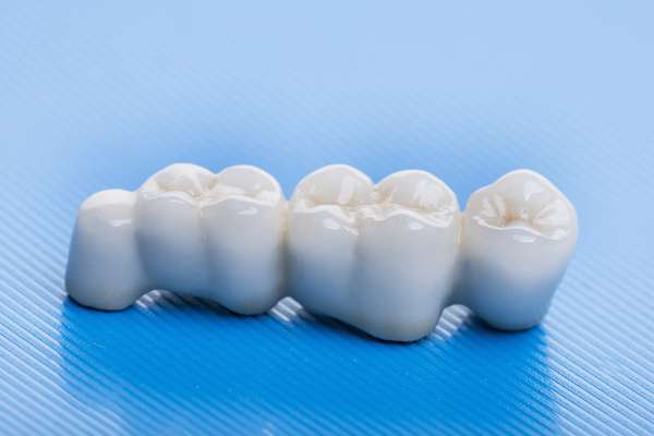 How Many Teeth Can Dental Bridges Replace from GDC Smiles in Gainesville, GA