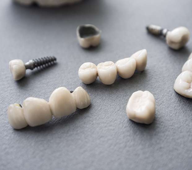 Gainesville The Difference Between Dental Implants and Mini Dental Implants