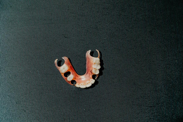 Tooth Replacement With Partial Dentures