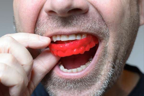 Save Your Teeth by Wearing Mouth Guards at Night from GDC Smiles in Gainesville, GA