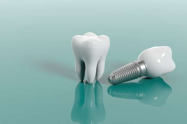 Multiple Teeth Replacement Options: One Implant for Two Teeth from GDC Smiles in Gainesville, GA